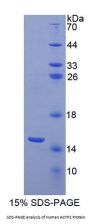 Human Acylphosphatase 1, Erythrocyte (ACYP1) Protein