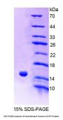Human Acylphosphatase 2, Muscle (ACYP2) Protein