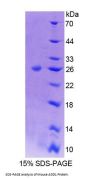 Mouse Alpha Adducin (ADD1) Protein