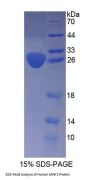 Human Aryl Hydrocarbon Receptor Nuclear Translocator 2 (ARNT2) Protein