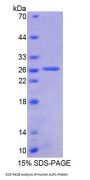 Human Ancient Ubiquitous Protein 1 (AUP1) Protein