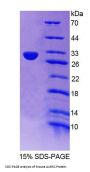 Mouse Aurora Kinase C (AURKC) Protein