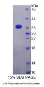 Rat Antizyme Inhibitor 1 (AZIN1) Protein