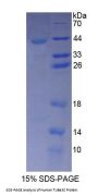 Human Tubulin Alpha 3C (TUBa3C) Protein