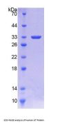 Human Antithrombin (AT) Protein