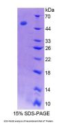 Rat Antithrombin (AT) Protein