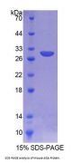 Mouse Aspartylglucosaminidase (AGA) Protein