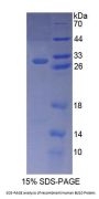Human B-Cell CLL/Lymphoma 10 (Bcl10) Protein