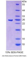 Human Core Binding Factor Beta Subunit (CBFb) Protein