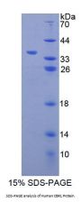 Human Carbonyl Reductase 1 (CBR1) Protein