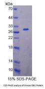 Mouse Carbonyl Reductase 1 (CBR1) Protein