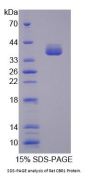 Rat Carbonyl Reductase 1 (CBR1) Protein