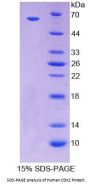 Human Caudal Type Homeobox Transcription Factor 2 (CDX2) Protein