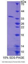 Human Carboxylesterase 1 (CES1) Protein