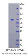 Mouse Carboxylesterase 1 (CES1) Protein