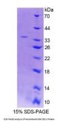 Rat Carboxylesterase 1 (CES1) Protein