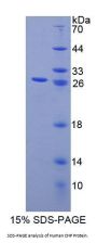 Human Calcium Binding Protein P22 (CHP) Protein