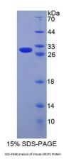 Mouse Cysteine Rich Secretory Protein 1 (CRISP1) Protein