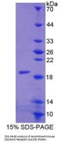 Mouse Calcitonin Receptor (CALCR) Protein
