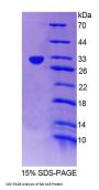 Rat Constitutive Androstane Receptor / CAR (NR1I3) Protein