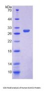 Human Engulfment And Cell Motility 2 (ELMO2) Protein