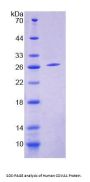 Human Cytosolic Ovarian Carcinoma Antigen 1 (COVA1) Protein