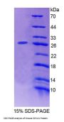 Mouse Cytosolic Ovarian Carcinoma Antigen 1 (COVA1) Protein