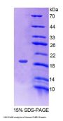 Human FK506 Binding Protein 2 (FKBP2) Protein