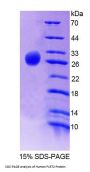 Human Fibronectin Leucine Rich Transmembrane Protein 2 (FLRT2) Protein