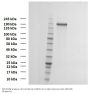 SARS-CoV-2 Spike Glycoprotein (D614G Mutation)