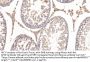 Apolipoprotein E (APOE) Antibody