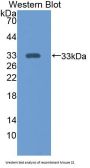 Citrate Synthase (CS) Antibody
