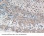 Citrate Synthase (CS) Antibody