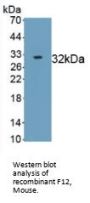 Coagulation Factor XII (F12) Antibody
