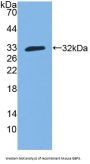 Guanylate Binding Protein 3 (GBP3) Antibody