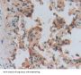 Sjogren Syndrome Antigen A2 (SSA2) Antibody