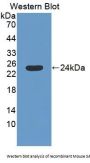 Spermidine/Spermine N1-Acetyltransferase 1 (SAT1) Antibody