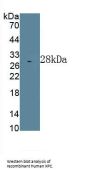 Xeroderma Pigmentosum, Complementation Group C (XPC) Antibody