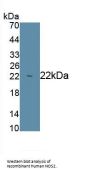 Nitric Oxide Synthase, Inducible (NOS2) Antibody
