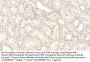 Nitric Oxide Synthase, Inducible (NOS2) Antibody