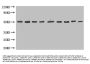 Myelin Basic Protein (MBP) Antibody