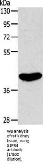 Sphingosine 1 Phosphate Receptor 4 (S1PR4) Antibody