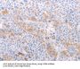 Sphingosine 1 Phosphate Receptor 4 (S1PR4) Antibody