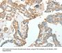 Actinin Alpha 1 (ACTN1) Antibody