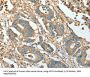 Actinin Alpha 1 (ACTN1) Antibody