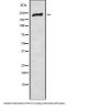Histone Acetyltransferase KAT6A (MYST3) Antibody