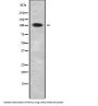 GC-Rich Sequence DNA-Binding Factor 1 (GCFC1) Antibody