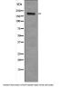 Proto-oncogene tyrosine-protein kinase receptor Ret Phospho-Tyr1096 (RET pY1096) Antibody