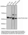 Glucose Transporter 2 / GLUT2 (SLC2A2) Antibody