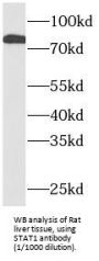 Signal Transducer And Activator of Transcription 1 (STAT1) Antibody